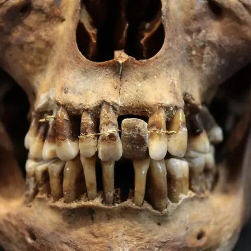 a human skull with teeth