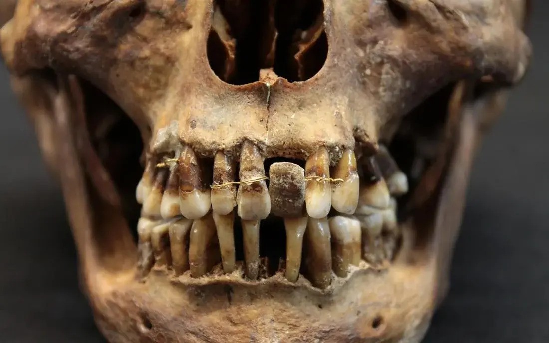 a human skull with teeth